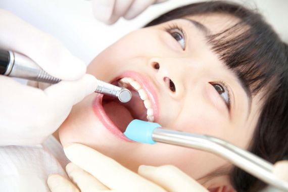 子どもの歯の施術